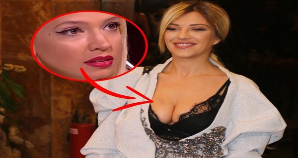 Kija juče pokazala OŽILJAK NA GRUDIMA, a evo kako izgleda dekolte Milice Todorović nakon NEZGODE!