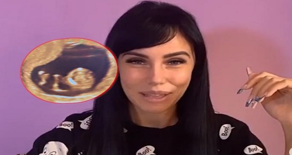 RADOSNE VESTI – DEČAK ILI DEVOJČICA? Nakon prvog ULTRAZVUKA, Subotićka KONAČNO otkrila POL BEBE