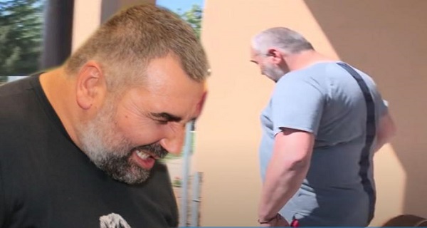 (FOTO) MODRICE I PODLIVI OKO OKA: Evo kako IZGLEDA Miki posle tuče sa Tomovićem – DOBIO ozbiljne BATINE