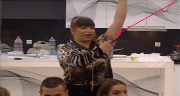 POKAZALA JEZIVE MODRICE! Miljana se OBRUŠILA na Janjuša: “On je G*VNO, P*COPEVAC I OLOŠ prema ženi”