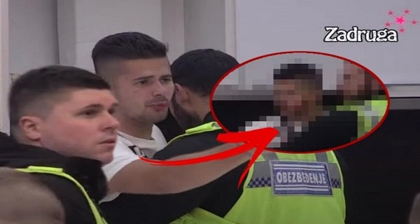 UNAKAŽENO LICE BILALA – POCEPALA MU KOŽU SA OBRAZA! Evo kako izgleda Brajlović nakon tuče sa Majom Marinković