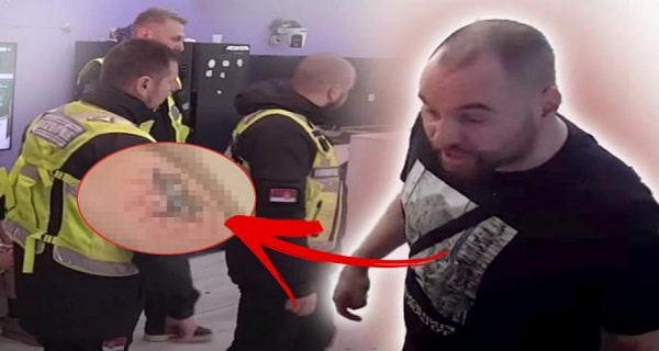 ISKASAPLJENA NOGA ZVEZDANA SLAVNIĆA: U Zadruzi je pokušao da odere tetovažu posvećenu Ani, a evo kako sad izgleda rana