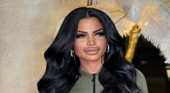 Snezana Bogdanovic bivša zadrugarka izvadila silikone iz usana, pa je šokirala mnoge pratioce svojim izdanjem