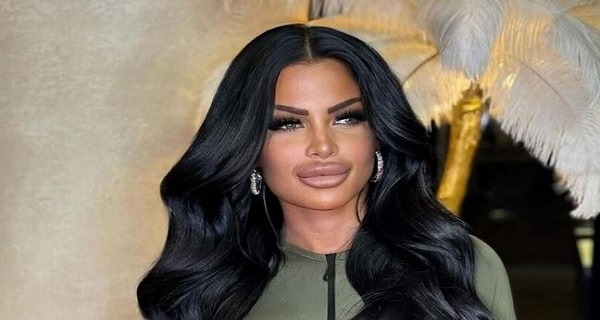 Snezana Bogdanovic bivša zadrugarka izvadila silikone iz usana, pa je šokirala mnoge pratioce svojim izdanjem