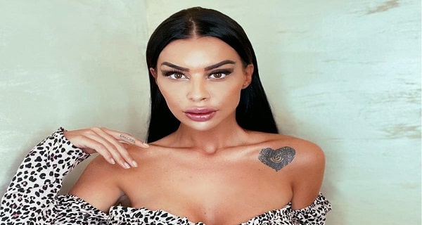 Bivša rijaliti učesnica dobila moždani udar – obratila se hitno javnosti: “Izgubila sam moć govora…”