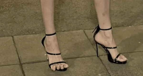 Šta je sa stopalom ove zadrugarke? Pojavila se na Pinkovoj žurki, a svi gledaju zgroženi u njene noge