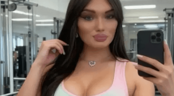 Ana Nikolić pokazala svoje telo posle promene pola i zapalila društvene mreže: Obline, silikoni i trbušnjaci pucaju na sve strane