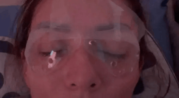 Drama bivše zadrugarke: Zbog očevih batina staklo joj povredilo oči, morala na operaciju: “Sekli mi rožnjaču na živo, kao slepa sam”