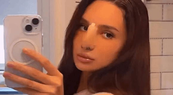 Nina Đogani pokazala nos nakon operacije: “I dalje sam otečena, ali konačno mogu da jedem”