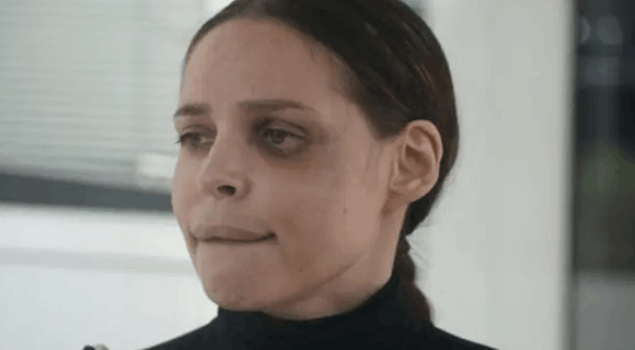 Šavija konačno pokazala lice posle operacija nakon teških povreda: Jedan detalj šokirao mnoge