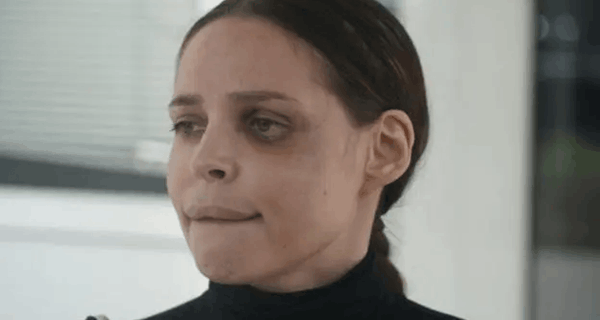 Šavija konačno pokazala lice posle operacija nakon teških povreda: Jedan detalj šokirao mnoge